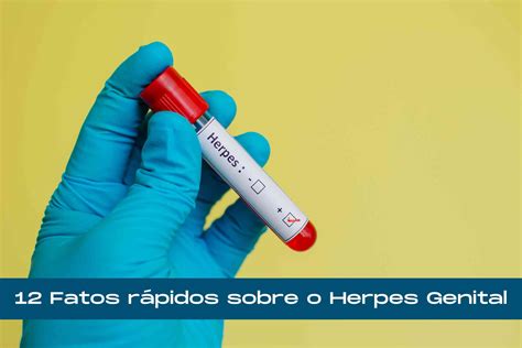 Herpes Roleta